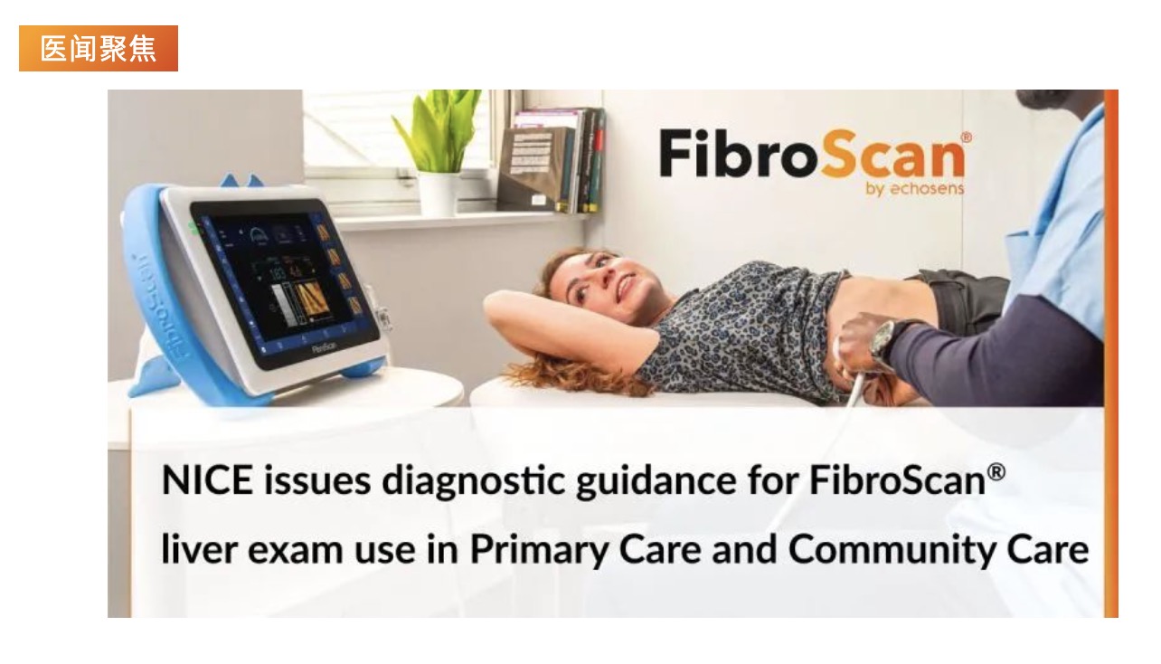 医闻聚焦 | NICE发布具有里程碑意义的指导意见，将常规肝脏扫描引入初级保健机构